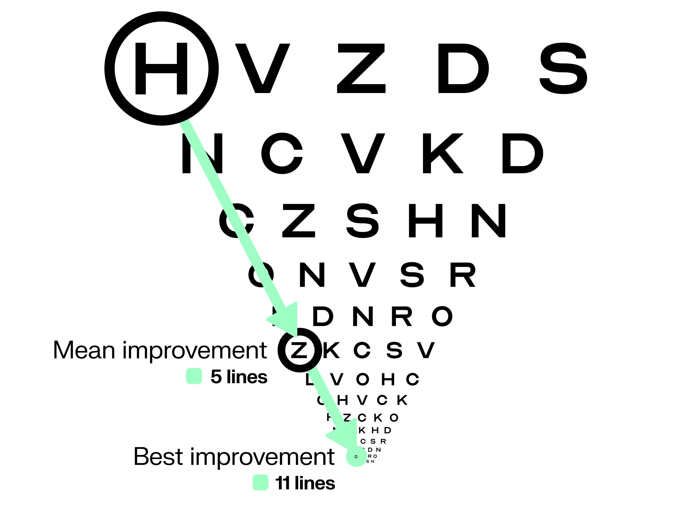 Eye chart showing how much vision patients gained with PRIMA in clinical trials. An arrow spans from the top of the chart down 5 lines, indicating the average visual acuity improvement of 25.5 letters with PRIMA. A second arrow continues down to 11 lines, indicating the best individual improvement of 59 letters.